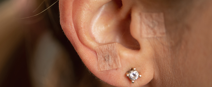 Bioresonanca Grilc, aurikuloterapija - Kuponko.si