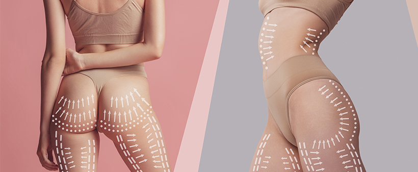 Valentyna massage, ročna anticelulitni masaža  - Kuponko.si