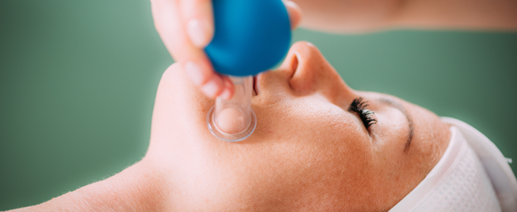 Nina Nails, cupping tretma za obraz - Kuponko.si