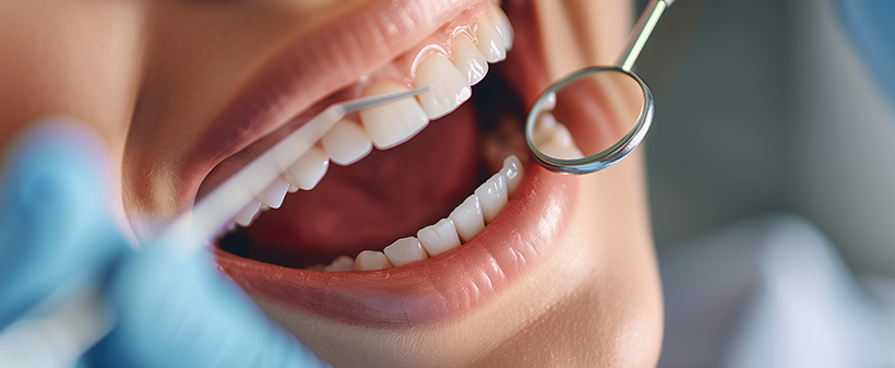 Zobozdravnica Tea: čiščenje zobnega kamna - Kuponko.si