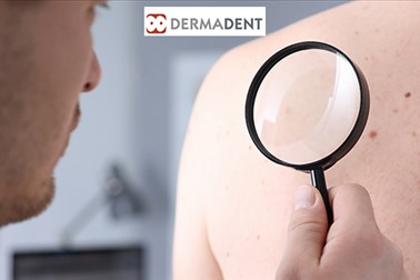 Dermatologija Dermadent: pregled kožnih znamenj