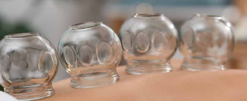 Salon MyDreams Ljubljana, masaža hrbta, ventuze - Kuponko.si