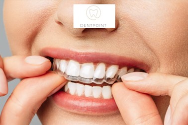 Dentpoint ordinacija, beljenje zob s folijami