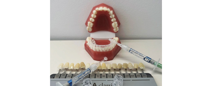 Dentpoint ordinacija, beljenje zob s folijami - Kuponko.si