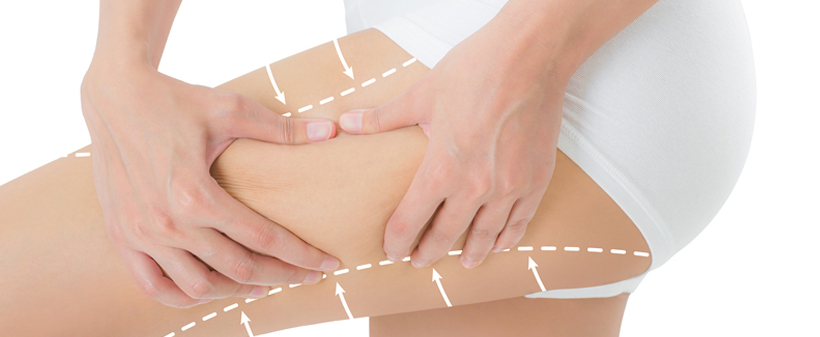 Studio Suzana: preoblikovanje telesa - Kuponko.si