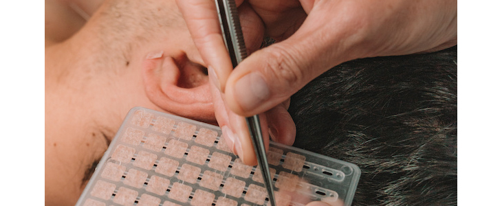 Bioresonanca Grilc, aurikuloterapija - Kuponko.si