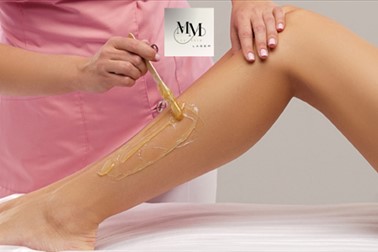 MM Lux Skin Laser: depilacija z voskom