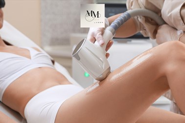 MM Lux Skin Laser: depilacija z voskom