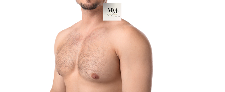 MM Lux Skin Laser: depilacija z voskom - Kuponko.si
