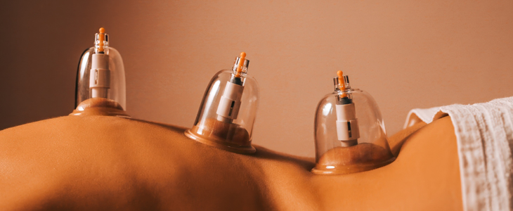 Amalet Studio, cupping vakuumska masaža - Kuponko.si