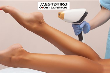Aestetika in zdravje: trajna depilacija