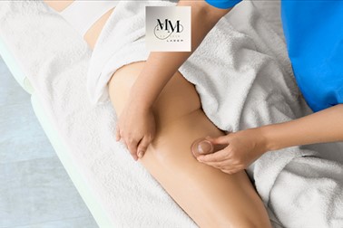 MM Lux Skin Laser: 45-minutna anticelulitna masaža