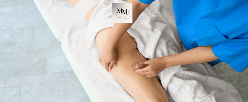 MM Lux Skin Laser: 45-minutna anticelulitna masaža - Kuponko.si