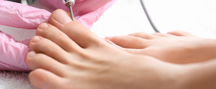 MM Lux Skin Laser: klasična pedikura - Kuponko.si