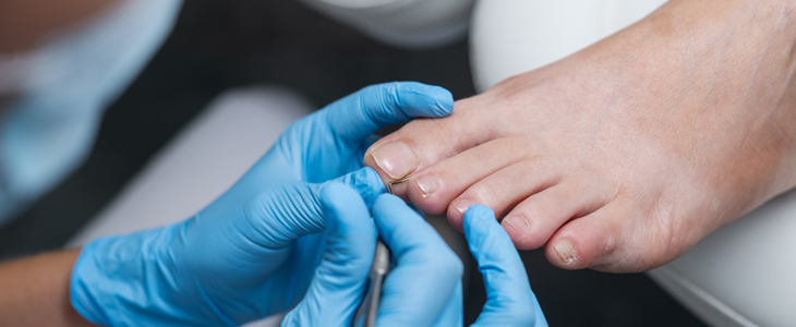 MM Lux Skin Laser: klasična pedikura - Kuponko.si