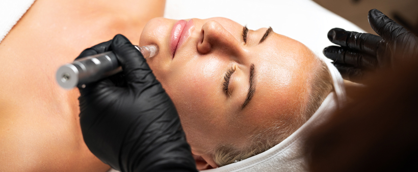 Nailash beauty studio, Microneedling obraza (1 obisk) - Kuponko.si
