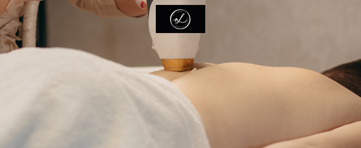 Nailash beauty studio, Lasersko odstranjevanje dlačic - Kuponko.si